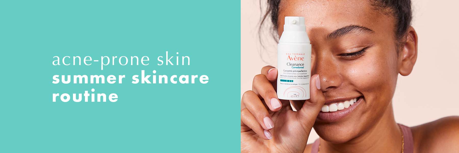 Acne-prone skin summer skincare routine