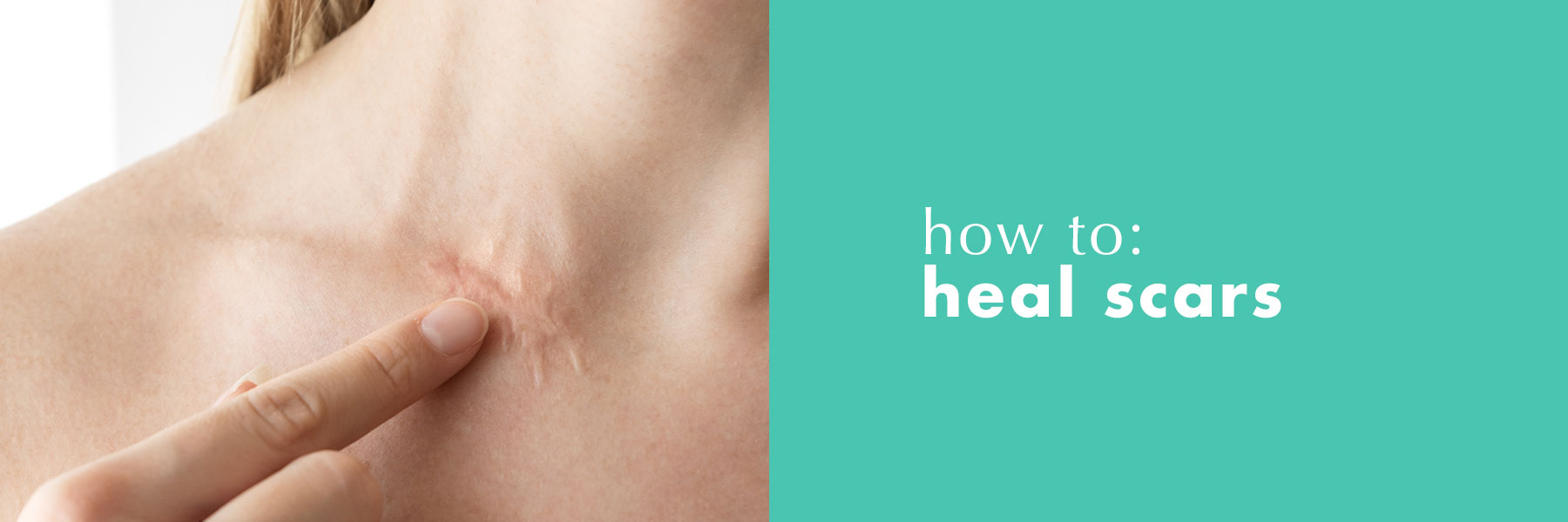 How to heal irritated skin