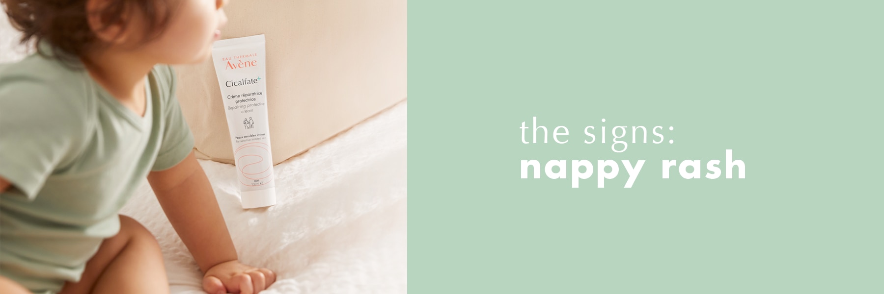 The signs of nappy rash