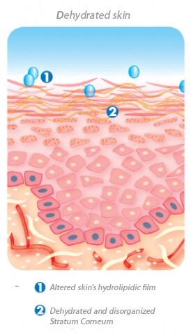 Dryness and dehydration | Eau Thermale Avène