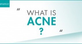 WHAT IS ACNE