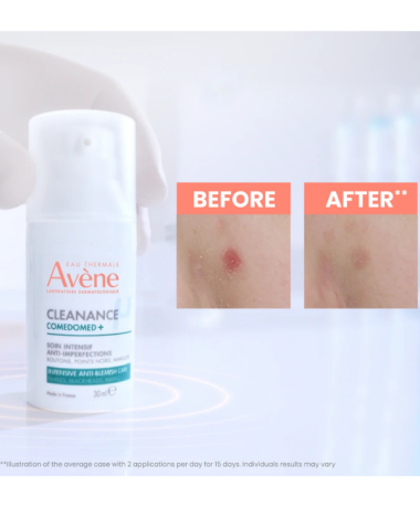 Avene Cleanance Comedomed+