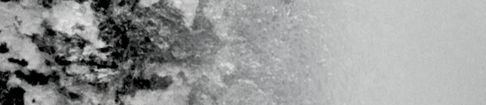 Reducera pigmentfläckar